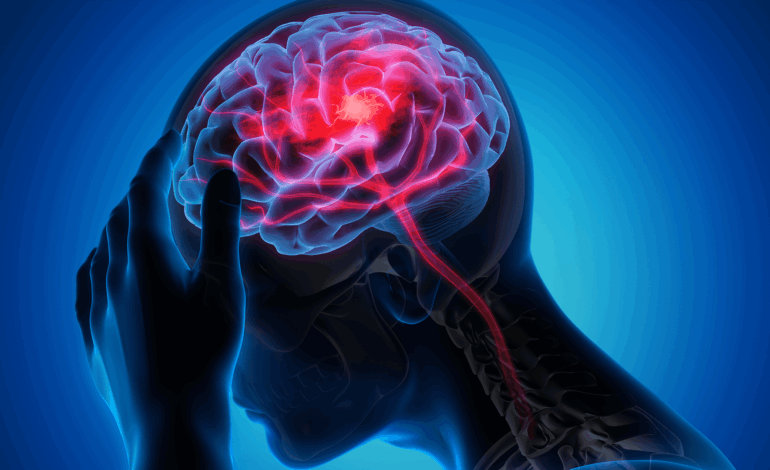 Derrame cerebral mata uma pessoa a cada seis minutos no Brasil, aponta estudo