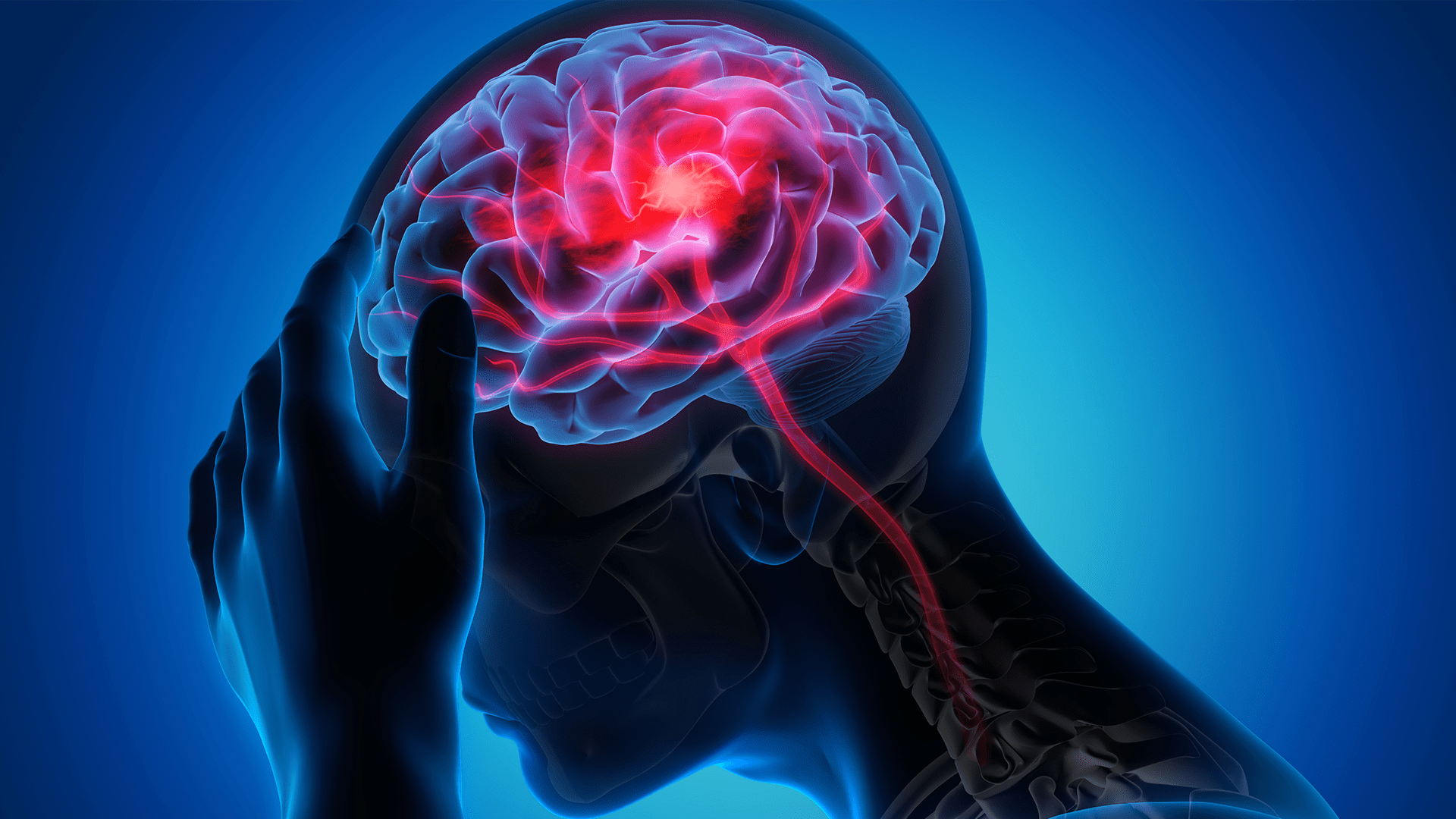 Derrame cerebral mata uma pessoa a cada seis minutos no Brasil, aponta estudo